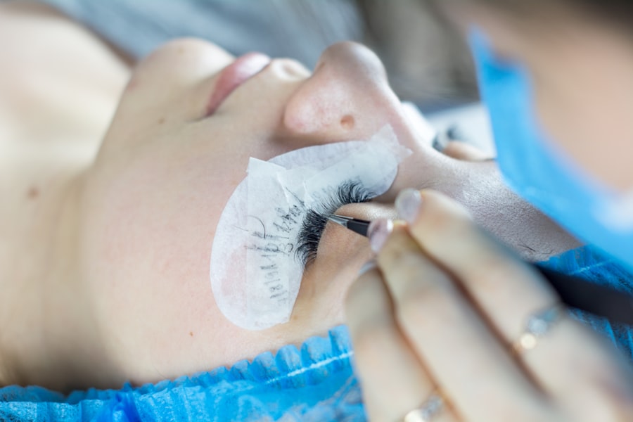 insurance companies cover lasik eye surgery