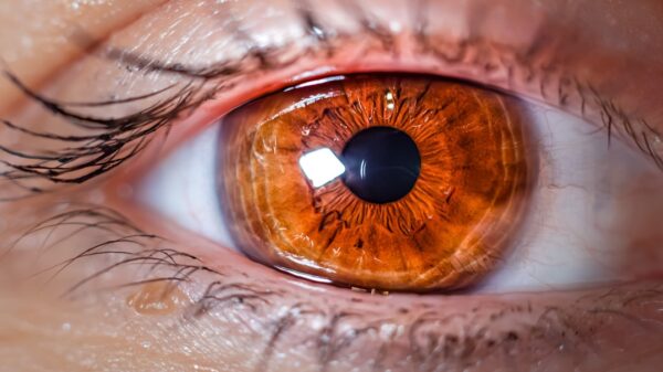 Photo insurance companies cover lasik eye surgery