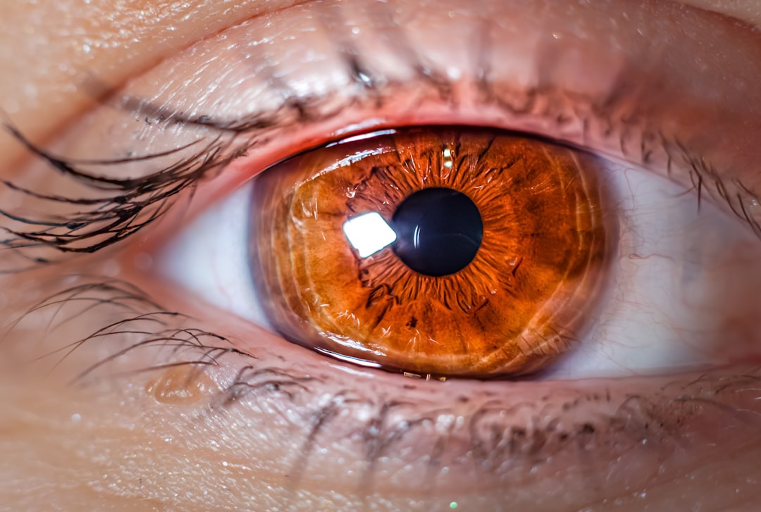 Photo insurance companies cover lasik eye surgery